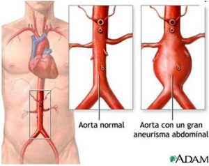 arteria aorta